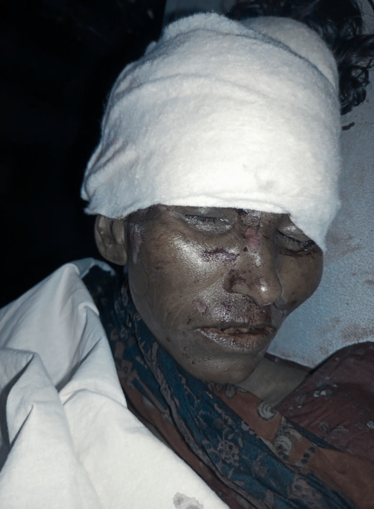 কাউনিয়ায় সড়ক দূর্ঘটনায় এক অজ্ঞাত মহিলার মৃত্যু