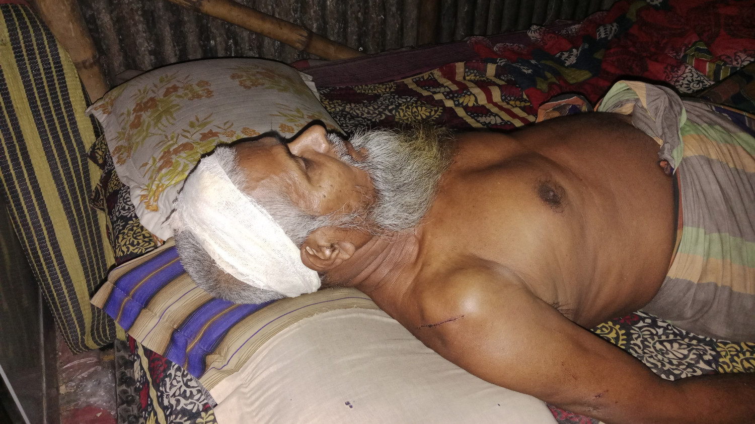 বোয়ালমারীতে তুচ্ছ ঘটনাকে কেন্দ্র করে সংঘর্ষ, নারী-পুরুষসহ আহত অন্তত ১০