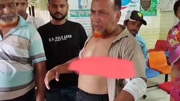 বোয়ালমারীতে অটোভ্যানের গতি কমাতে বলায় সাংবাদিককে লোহার পাইপ ও লাঠিসোটা দিয়ে মারধর, থানায় লিখিত অভিযোগ